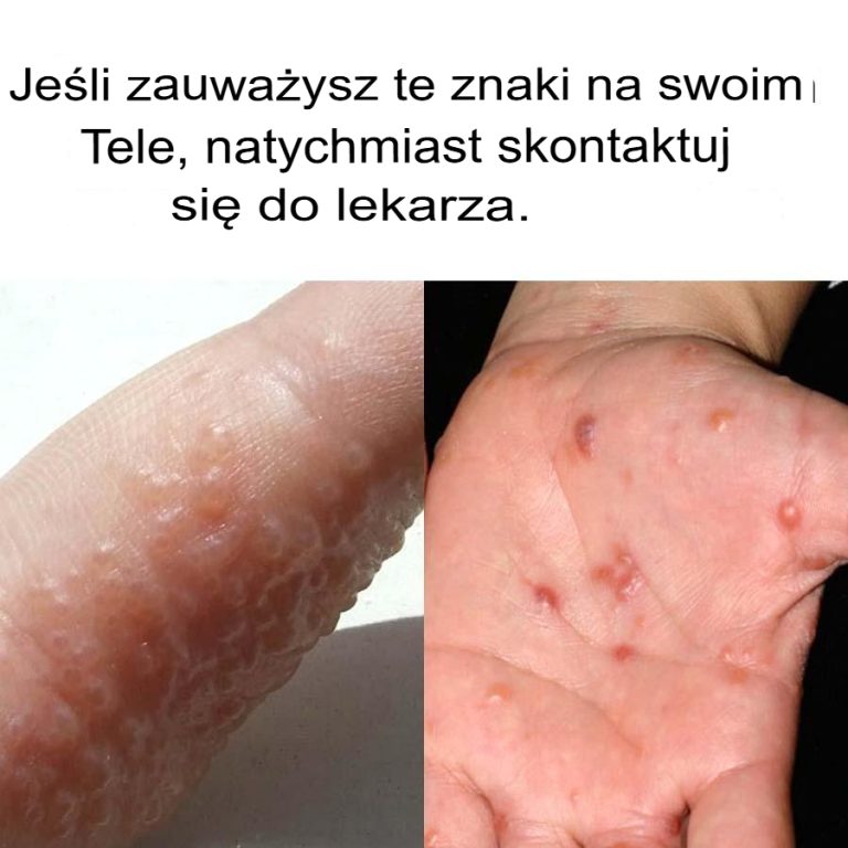 Jeśli zauważysz te objawy na swoim ciele, natychmiast skonsultuj się z lekarzem