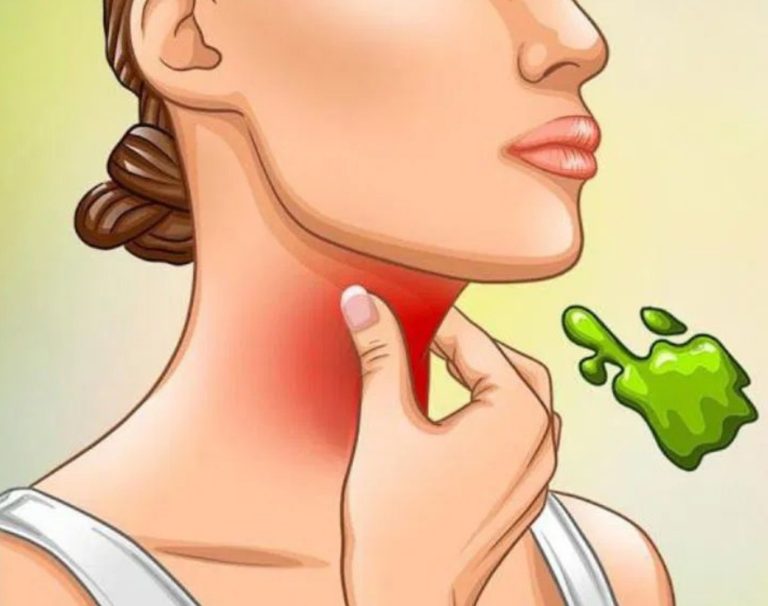 Prawdziwe przyczyny śluzu w gardle i jak się go pozbyć