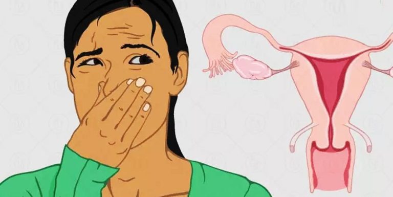 Dlaczego części intymne mogą pachnieć rybą?