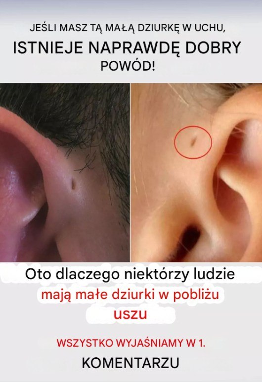 Czy Twoje dziecko ma małą dziurkę w uchu? Oto, co to jest