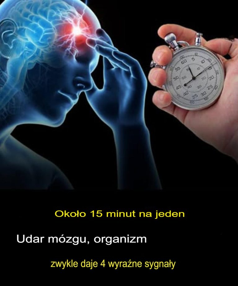 Udar mózgu – 4 wyraźne sygnały ostrzegawcze, których nie wolno ignorować