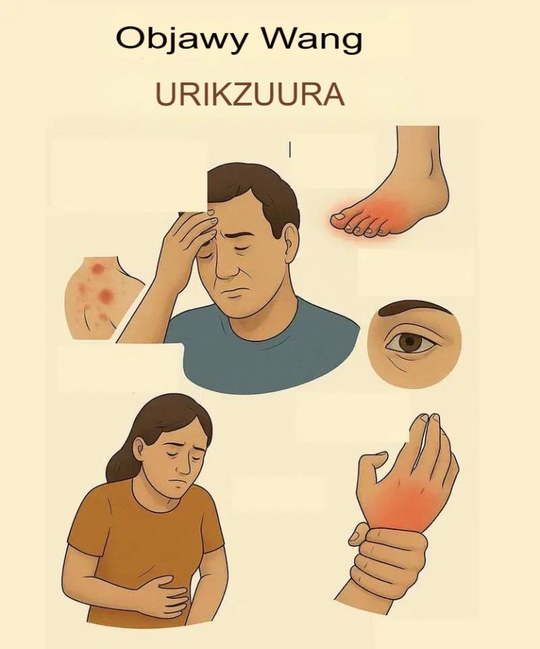 Produkty spożywcze pomagające regulować poziom kwasu moczowego