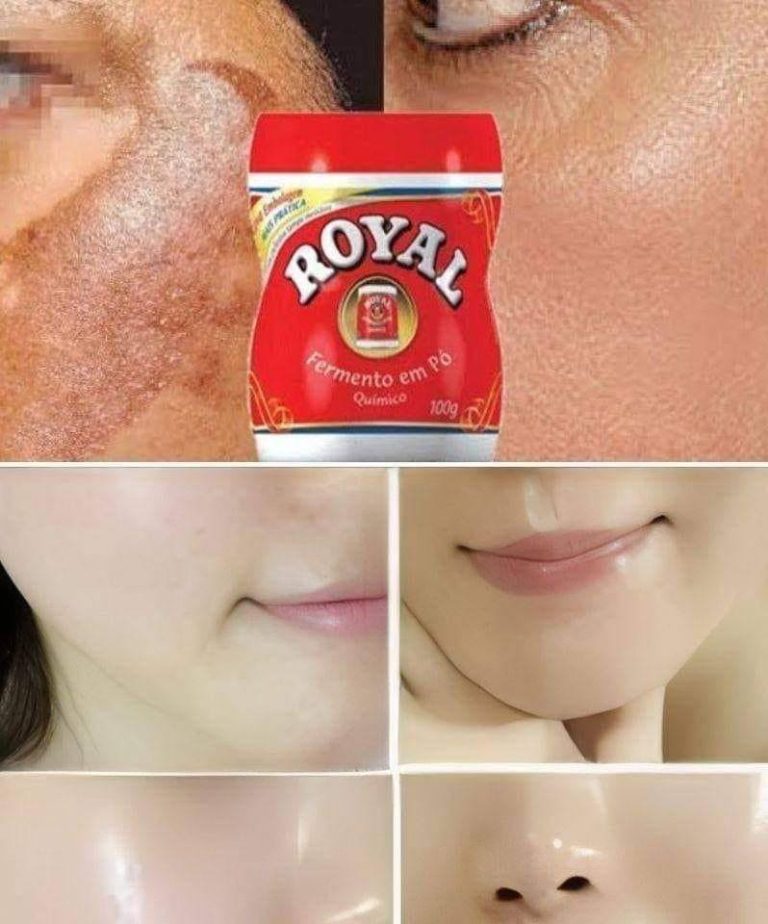 skórę dziecka w ciągu kilku dni dzięki temu domowemu przepisowi, zapisz SKŁADNIKI