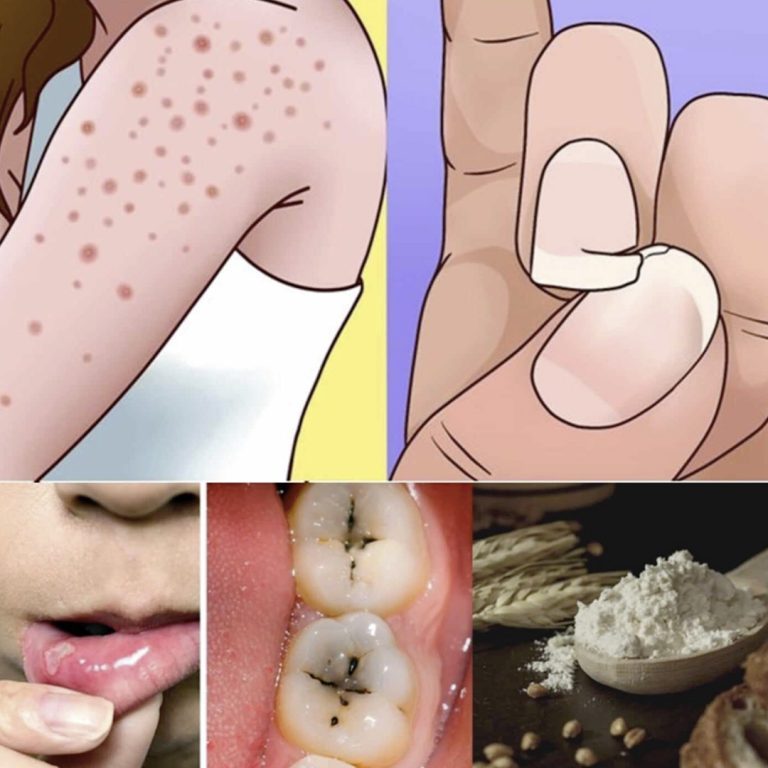 9 oznak nietolerancji glutenu, które każdy powinien znać