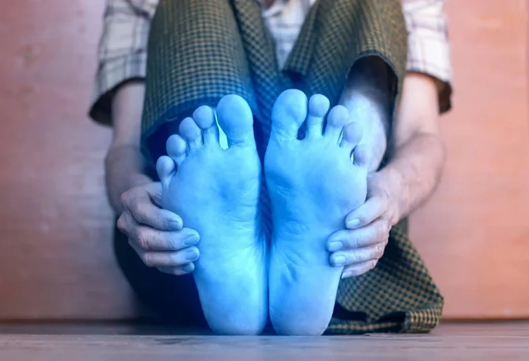 6 powodów, dla których Twoje stopy są zimne