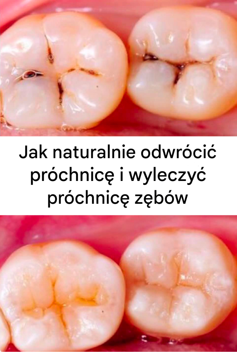 8 potężnych domowych hormonów ukorzeniających | Naturalne stymulatory ogrodnicze