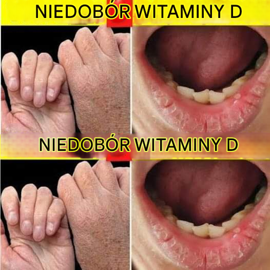 8 najczęstszych nieoczekiwanych przyczyn niedoboru witaminy D