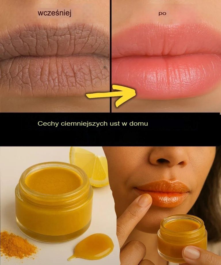 Leczenie ciemnych ust w domu