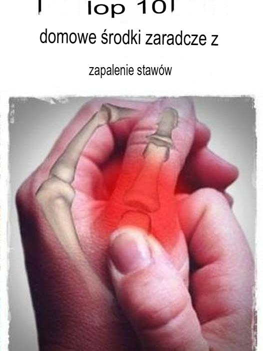 10 najlepszych domowych sposobów na zapalenie stawów