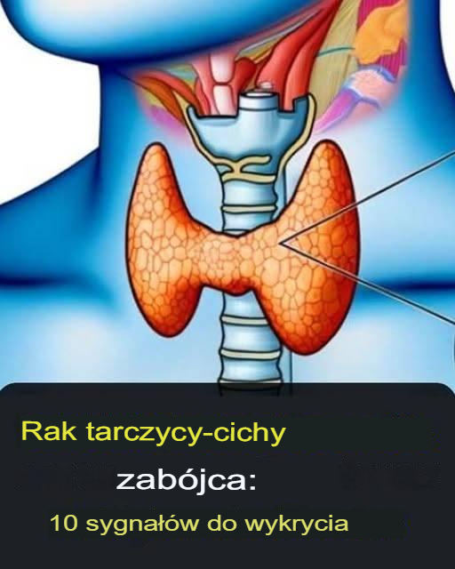 Tarczyca: 3 objawy, które mogą wskazywać na raka