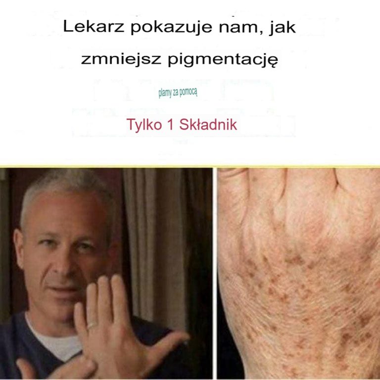 Tak wyglądały moje dłonie 15 dni przed zastosowaniem tego domowego środka – będziesz zdumiony efektami