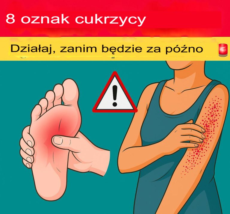 8 objawów cukrzycy: działaj zanim będzie za późno!