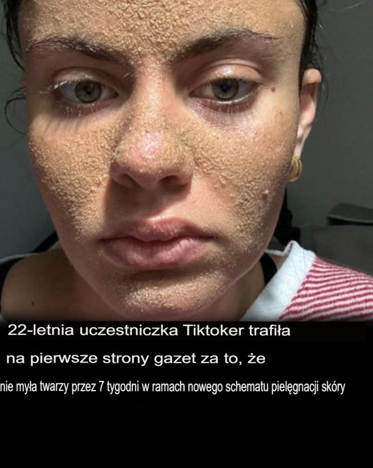 22-latka staje się popularna, bo nigdy nie myje twarzy