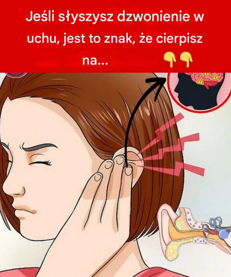 Jeśli słyszysz dzwonienie w uchu, jest to znak, że cierpisz na…