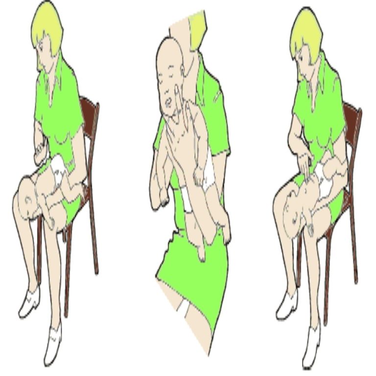 Pierwsza pomoc w zapobieganiu zadławieniom u niemowląt