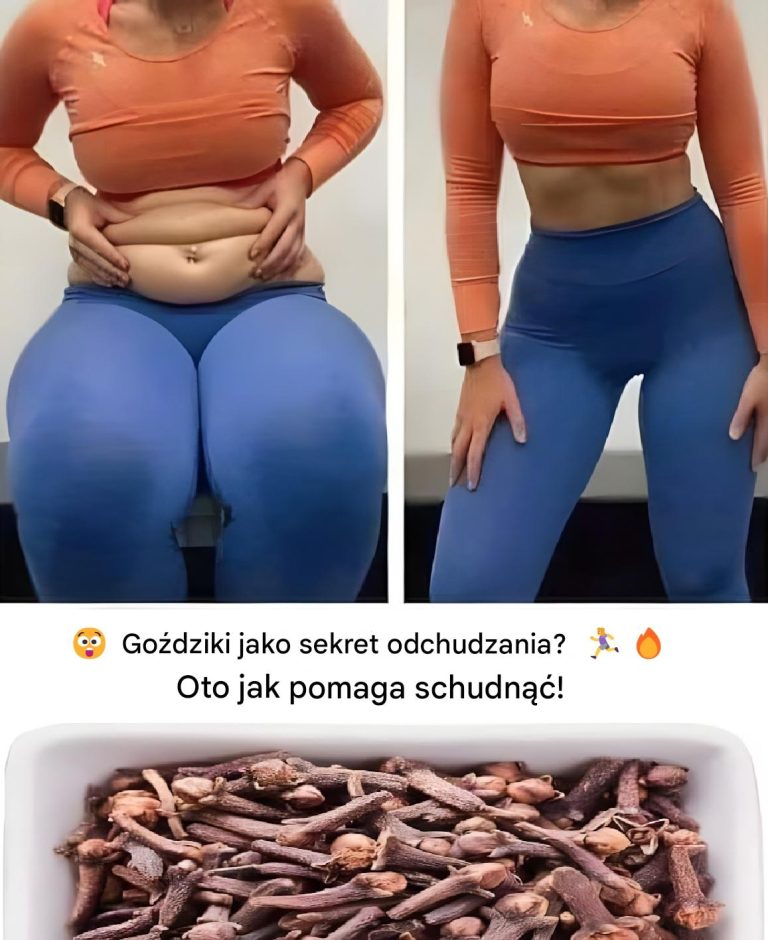 Jak stosować goździki w celu utraty wagi