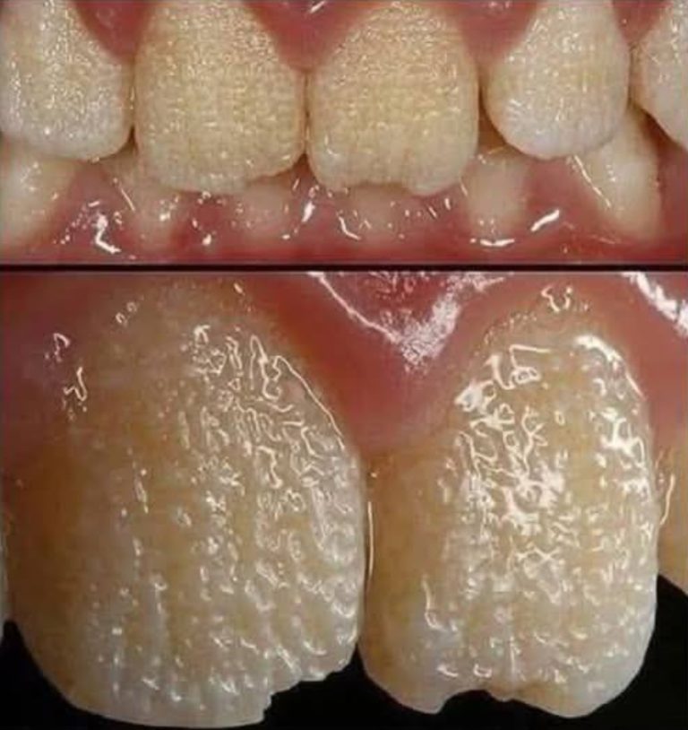 Uważaj!! Tak będą wyglądały Twoje zęby, kiedy będziesz jadł…