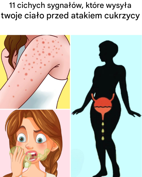 11 CICHYCH SYGNAŁÓW, KTÓRE WYSYŁA TWOJE CIAŁO PRZED ATAKIEM CUKRZYCY