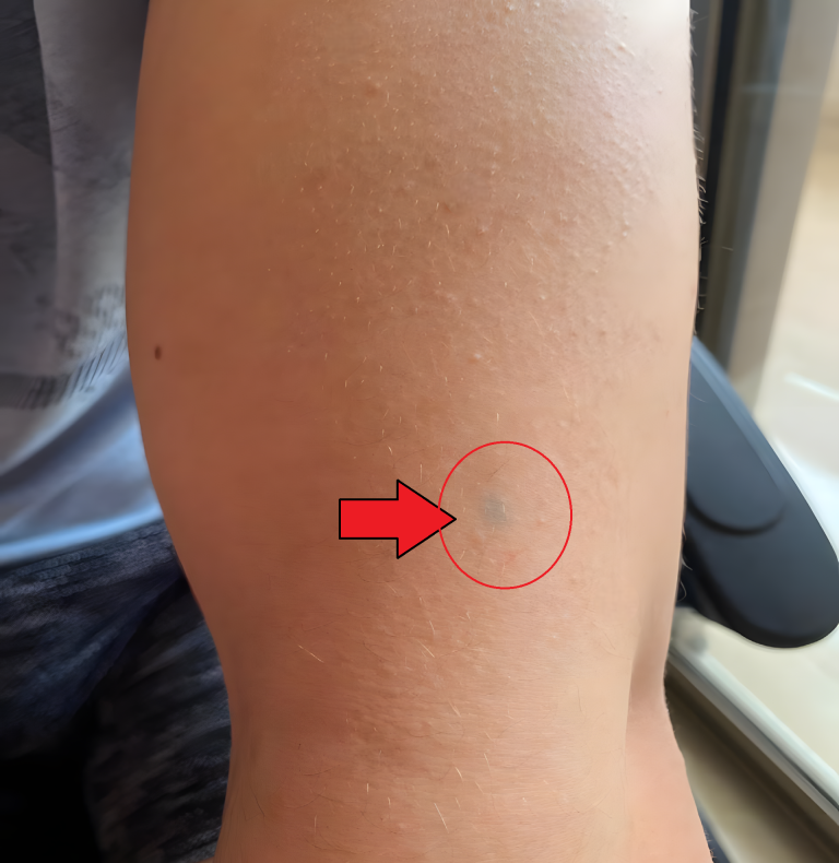 Nagle na twojej skórze pojawia się mała zielona plamka, zupełnie jak tatuaż. Oto co to oznacza…