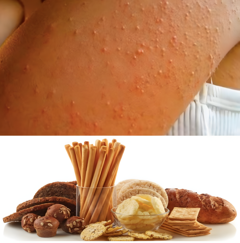 Czy przeszkadzają Ci te pryszcze na ciele? Dowiedz się, dlaczego się pojawiają i jak sprawić, żeby zniknęły.