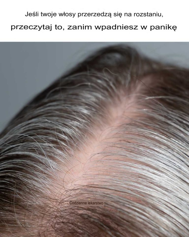 Nie miałem o tym pojęcia