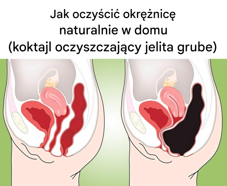 Jak naturalnie oczyścić jelito grube w domu (koktajl oczyszczający jelito grube)