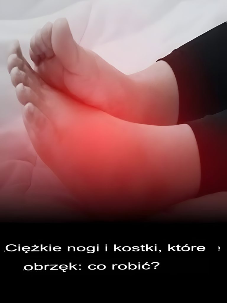 Czy Twoje nogi i stopy są opuchnięte? Dziesięć wskazówek, które należy zastosować natychmiast i zmniejszyć opuchliznę