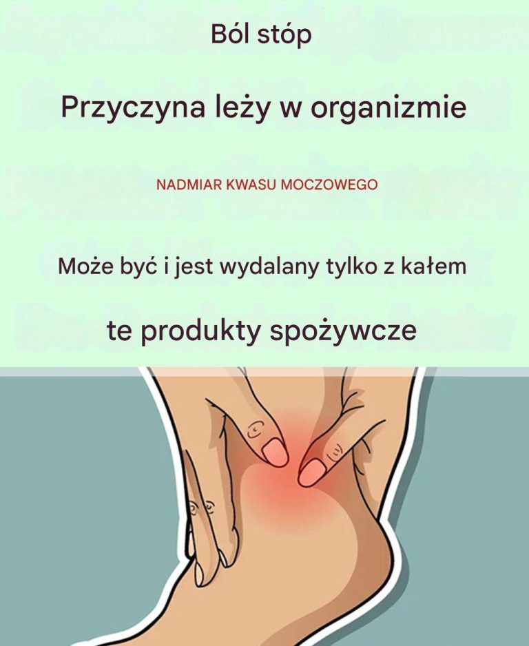 8 produktów spożywczych, które mogą obniżyć poziom kwasu moczowego w organizmie