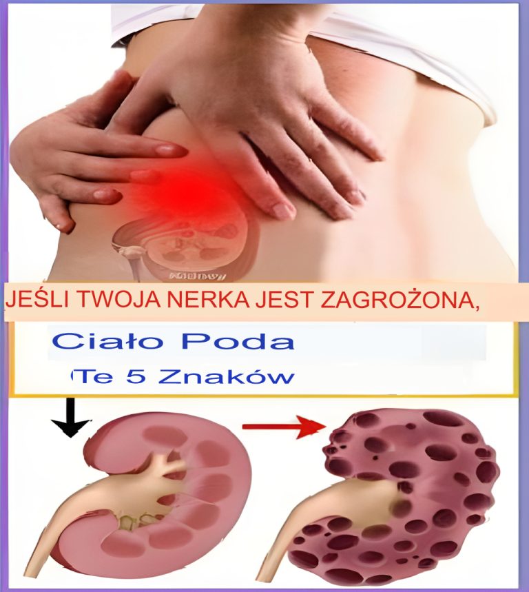 5 PRODUKTÓW ŻYWNOŚCIOWYCH, KTÓRE ODBLOKUJĄ TĘTNICE I WALCZĄ Z CHOLESTEROLEM