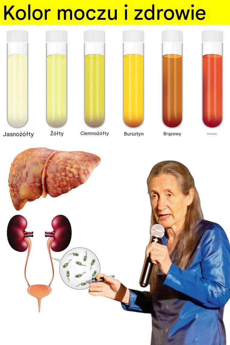 Co kolor moczu mówi o Twoim zdrowiu