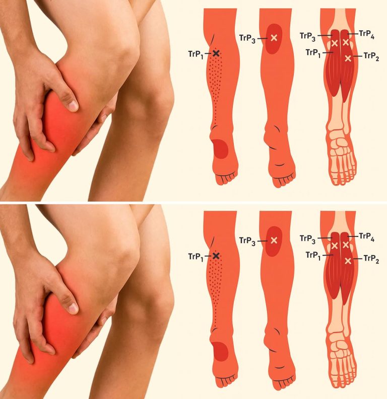 Ból nóg: dlaczego jest tak powszechny i jak złagodzić go w kilka minut.