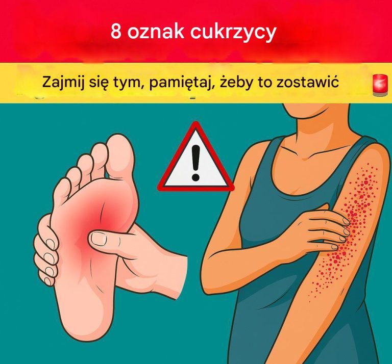 8 objawów cukrzycy: podejmij działanie zanim będzie za późno!