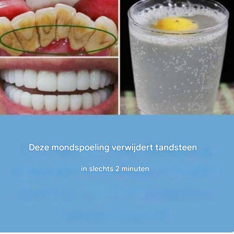 Jak mieć białe zęby: 11 wskazówek, jak mieć piękny uśmiech!