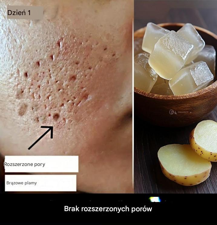 Przekształć skórę w otwarte pory i szkło