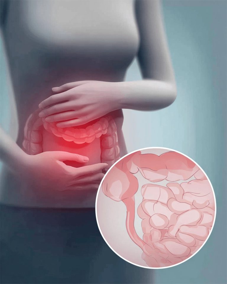 Kompletny przewodnik po zdrowiu jelit: fermentowane produkty spożywcze, prebiotyki i leczenie mikrobiomu