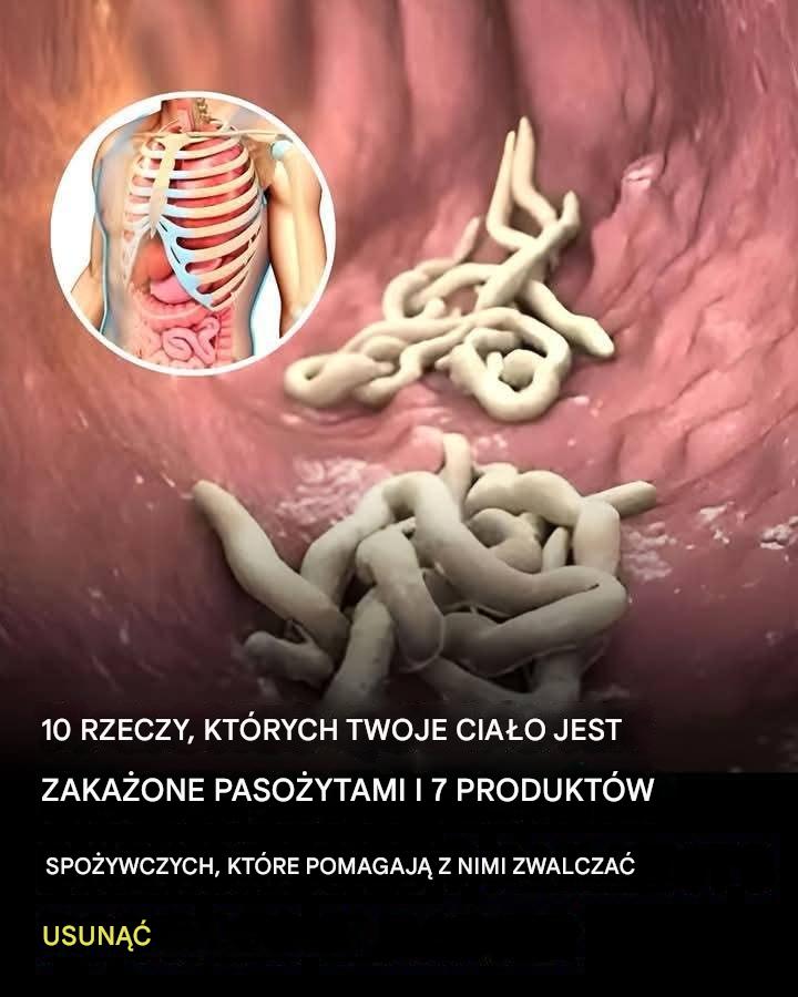 10 oznak, że w Twoim organizmie jest pełno pasożytów