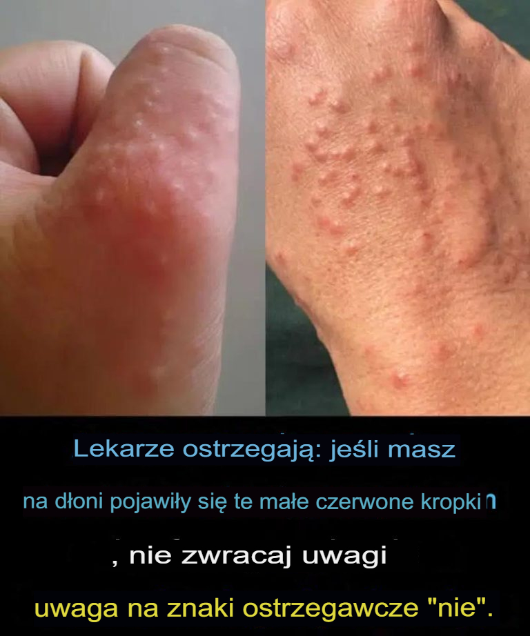 Nie ignoruj tych małych czerwonych plamek na ramieniu – mogą to być ważne sygnały ostrzegawcze
