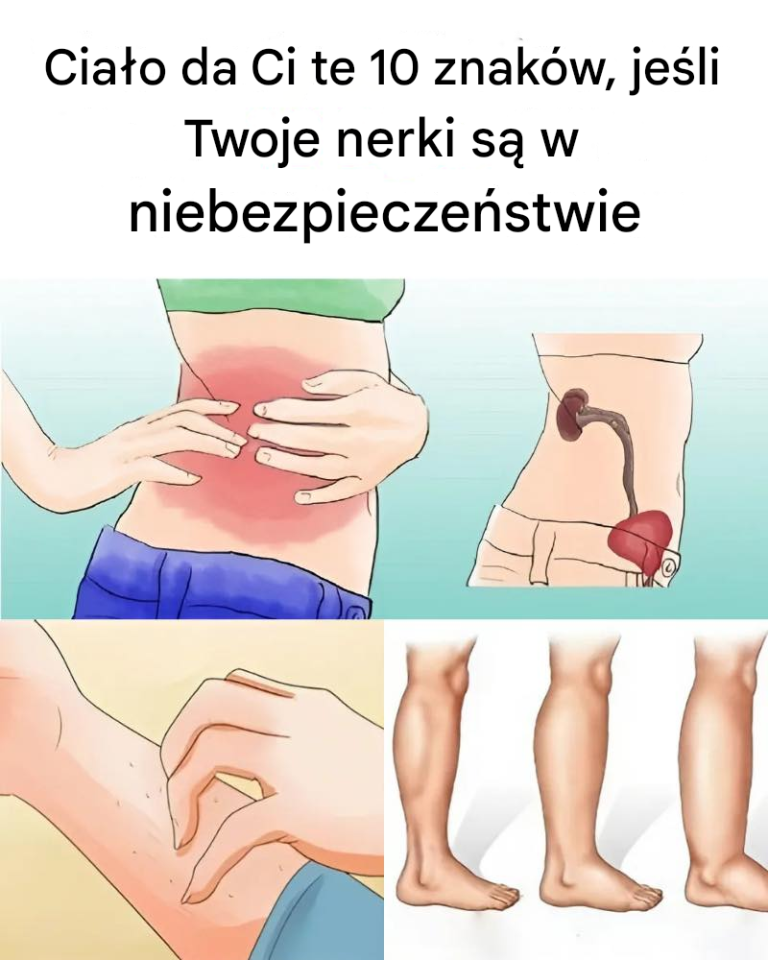 10 objawów choroby nerek