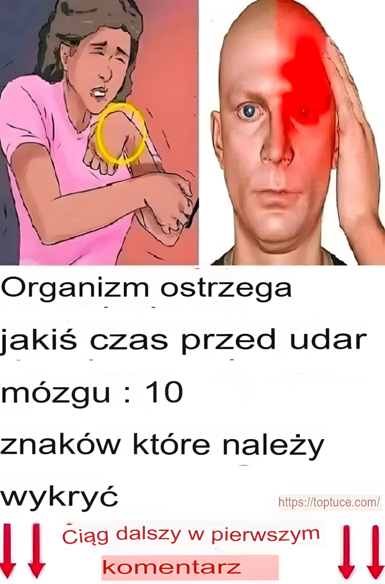 10 objawów udaru mózgu, na które należy zwrócić uwagę u bliskich