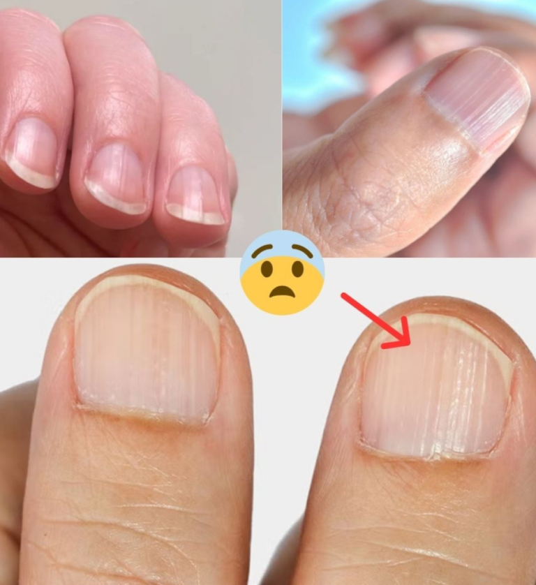 Lekarz ujawnia 7 problemów zdrowotnych ukrytych w paznokciach — co mogą one oznaczać