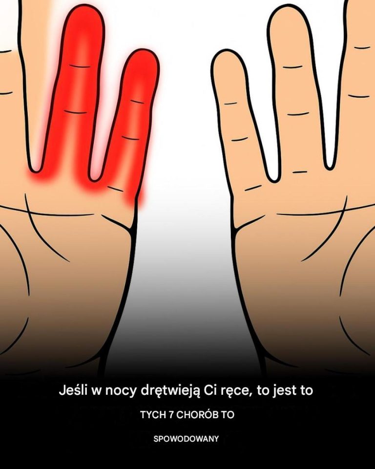Dlaczego w nocy drętwieją mi ręce?