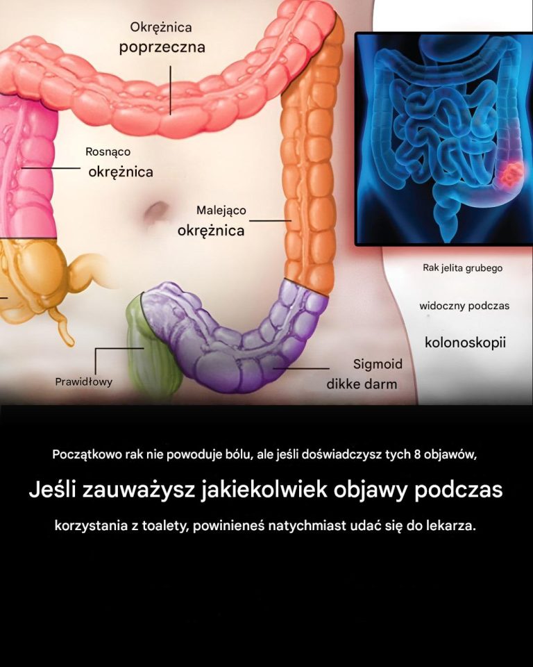 7 ostrzegawczych objawów raka jelita grubego, których nigdy nie należy ignorować