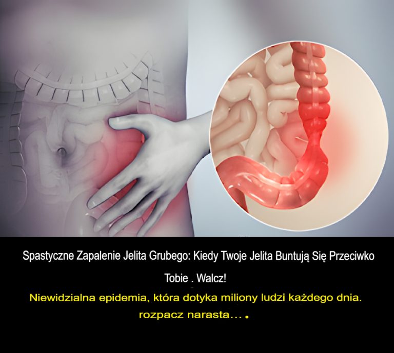 Spastyczne zapalenie jelita grubego: Kiedy twoje jelita walczą z tobą! Niewidzialna epidemia, która każdego dnia doprowadza miliony ludzi do rozpaczy…