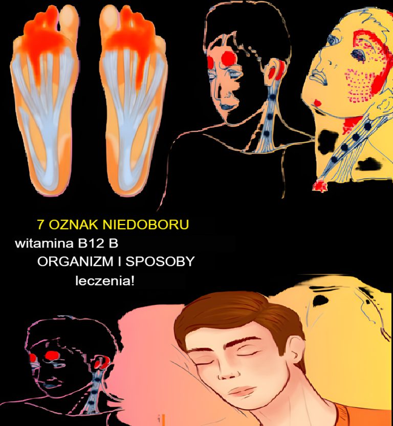 7 objawów niedoboru witaminy B12 i jak go leczyć!