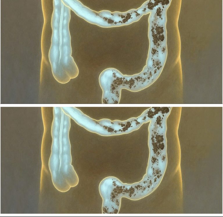 Ekspresowy detoks: Oczyść swoje jelita w mniej niż tydzień dzięki temu naturalnemu duetowi.