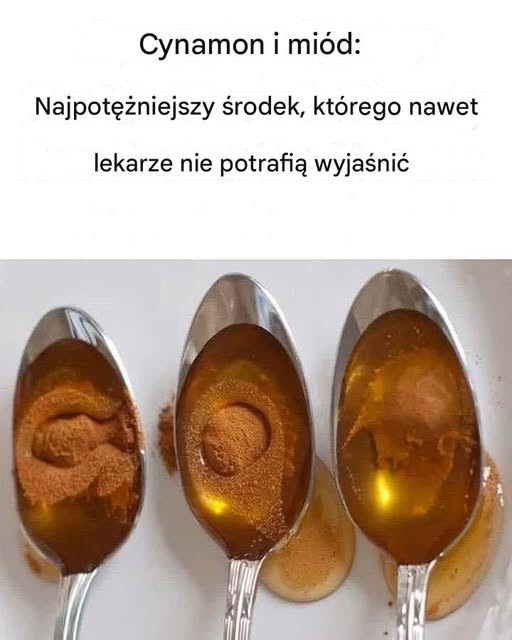 Cynamon i miód: najskuteczniejszy środek, którego nawet lekarze nie potrafią wyjaśnić