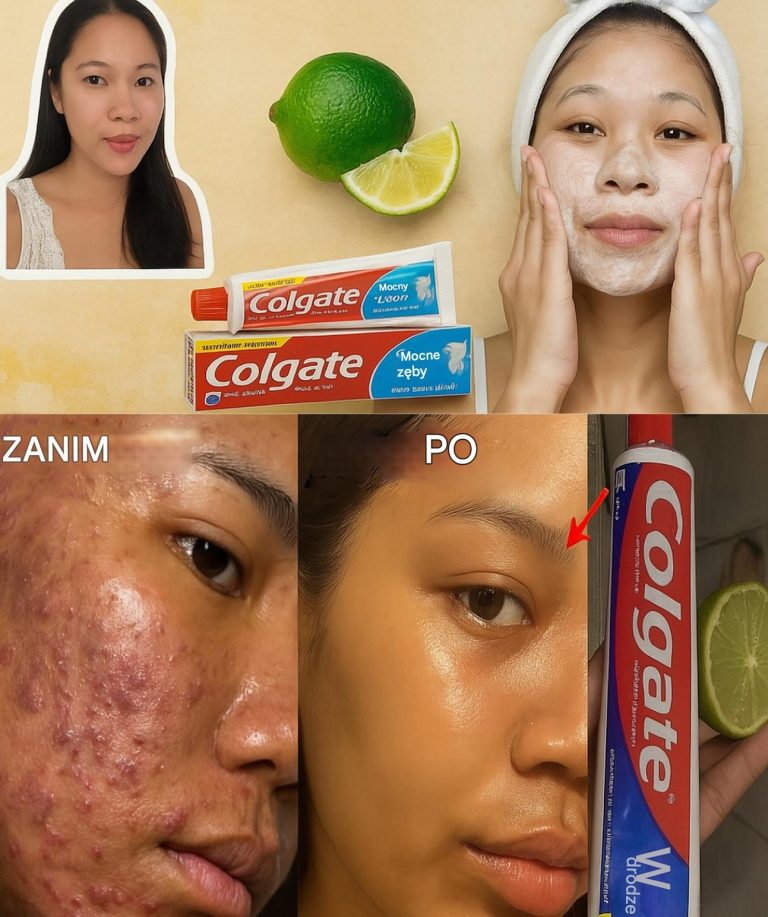 Dlaczego tak dużo mówi się o triku z Colgate i cytryną?