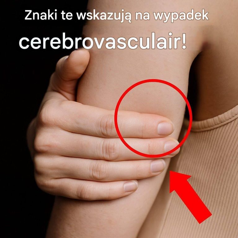 Czy to zmęczenie, czy udar? Kobiety nie powinny ignorować tych sygnałów ostrzegawczych.