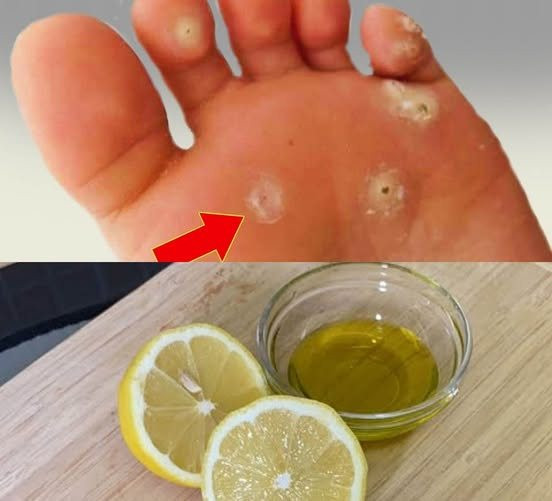 Usuń odciski dzięki temu naturalnemu zabiegowi