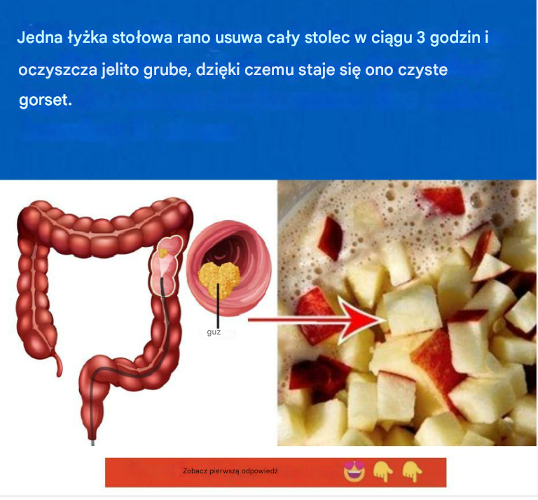 Zaparcia: Tak, istnieją 3 naturalne sposoby, które można wykorzystać w celu ochrony swojej diety.